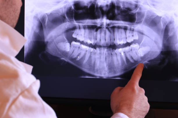 Best Emergency Root Canal Treatment in Middlefield, OH