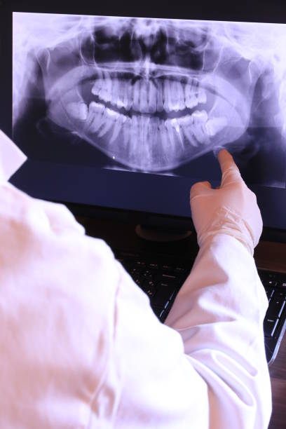 Best Emergency Dentist for Lost Fillings or Crowns in Middlefield, OH